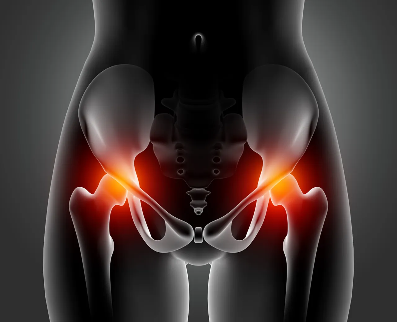 Hip pain treatment and chiropractic care at Advanced Injury and DISC Center in Duluth GA